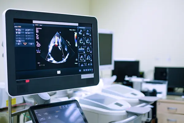WS-Echocardiography